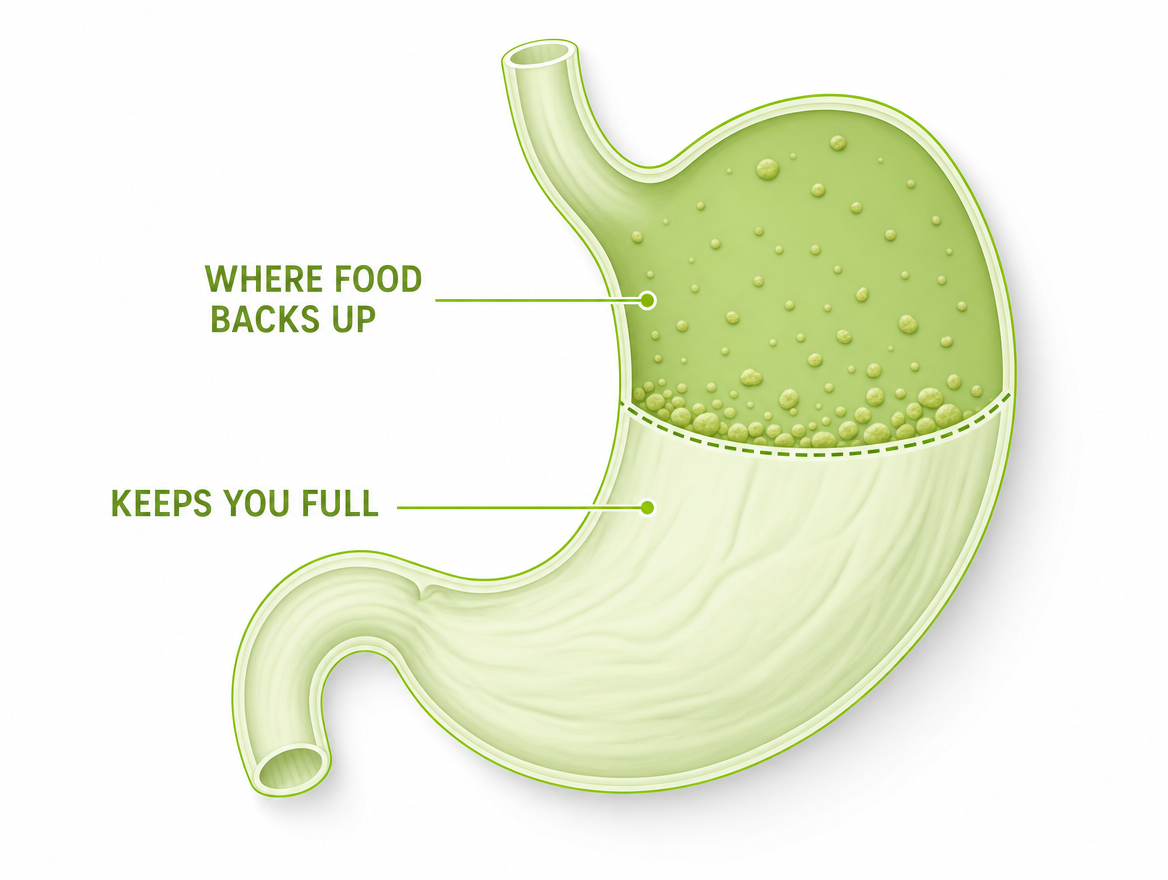 Two-zone stomach diagram: keeps you full vs where food backs up